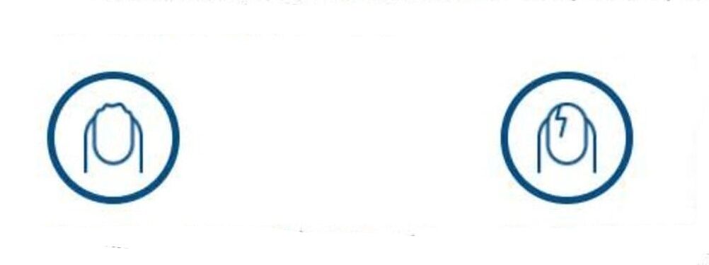 Deformación das uñas por infección por fungos